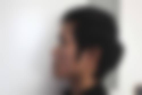 隆鼻硅胶膨体哪个好——北京八大处整形