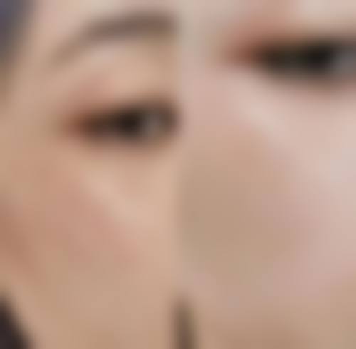 北京朗丽嘉整形医院怎么样，口碑评价如何？