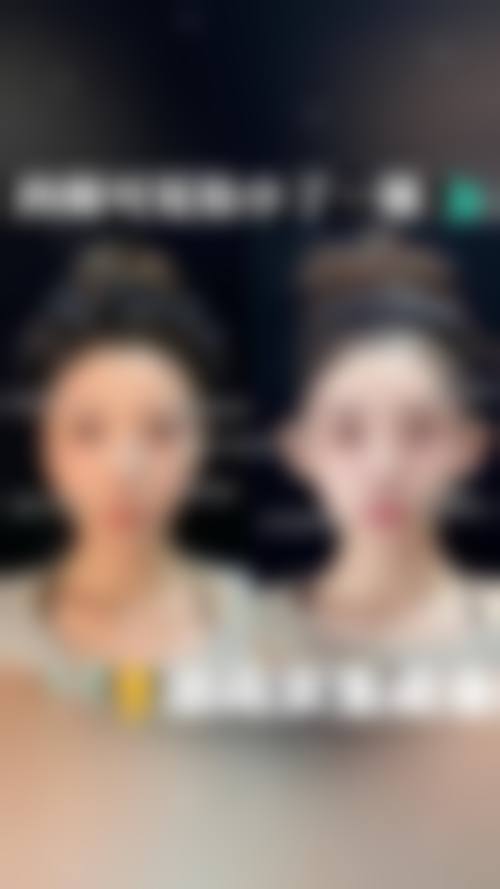 天津河东美泽医学美容门诊部价格表