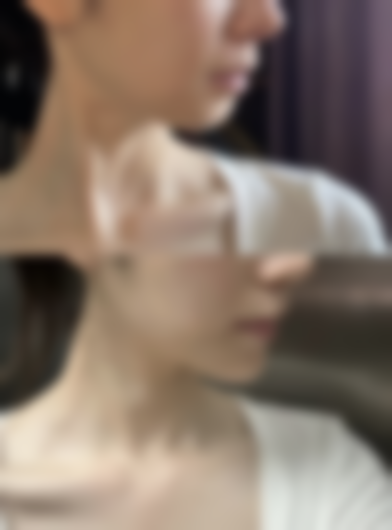 乳房大抽脂的医院选择与风险规避