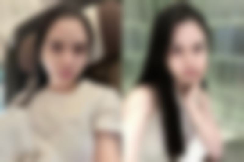 三等甲医院与私立医院对比下头发种植能保持多久时间