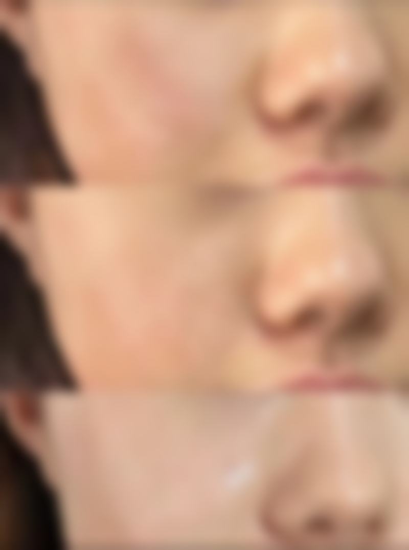 瘦脸针下巴一起打脸会变小吗——神秘医美机构之一