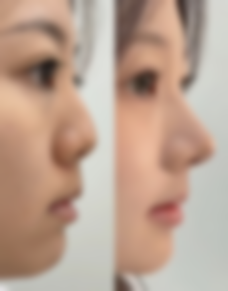 生姜敷眼袋的合理时长