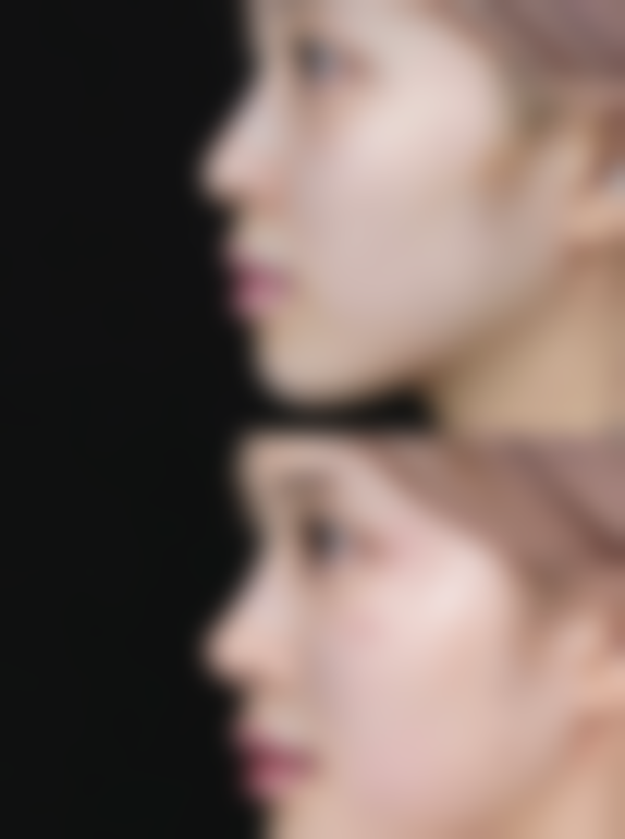 赵娟医生项目优势突出