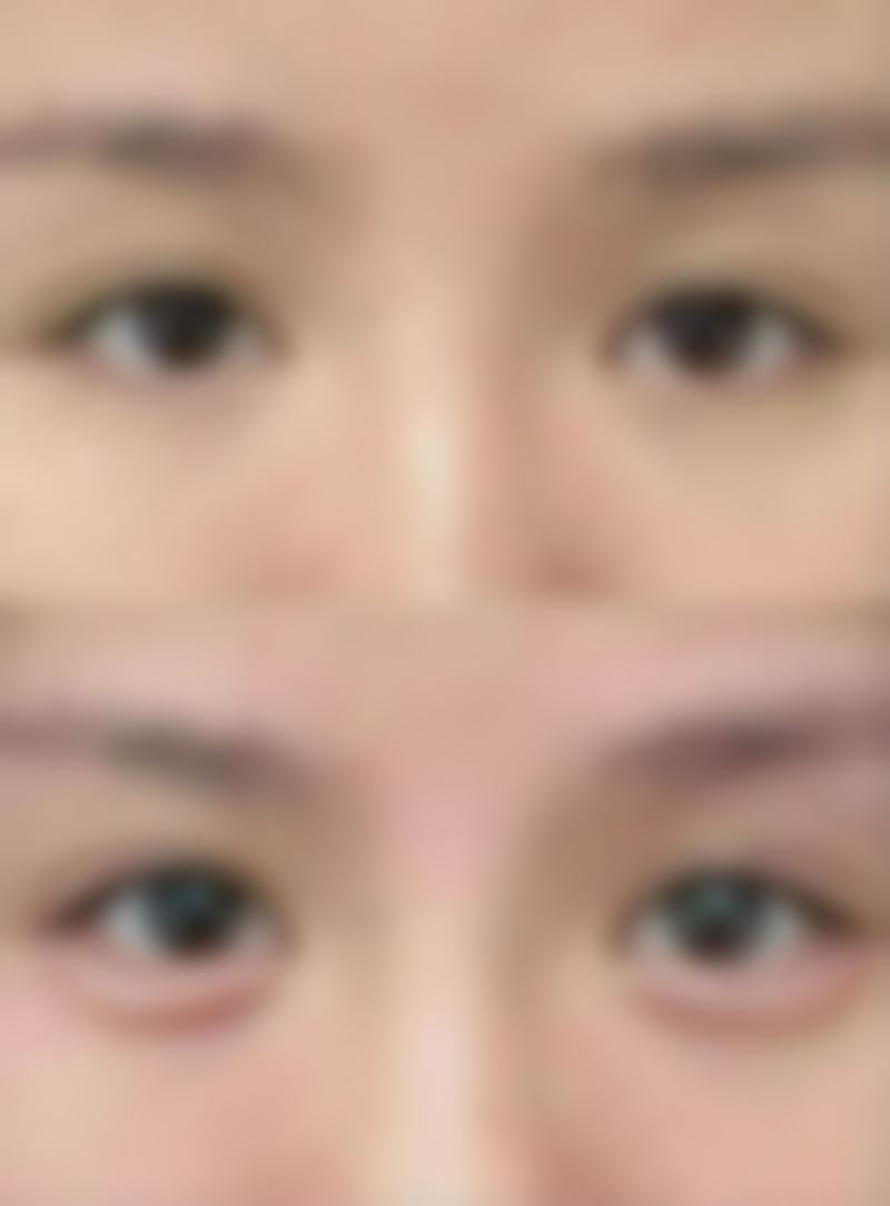 做双眼皮手术会有危险吗之医院和医生的选择要点——机构选择：三等甲医院 vs 美容院生死对决