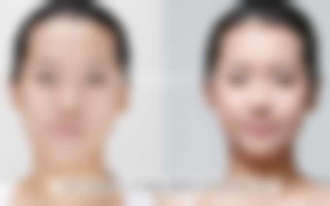 韩国REGEN丽珍整形外科医院