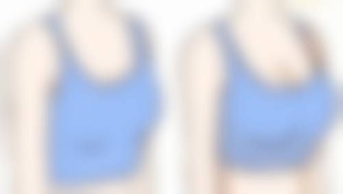 圆形脸:什么脸型需要打瘦脸针之圆形脸成因与对策