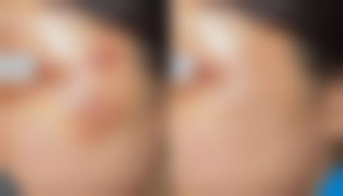 邹洁医生简介口碑如何