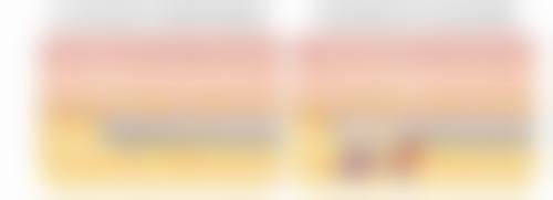 眼袋好显老怎么办:3招快速消除眼袋救急