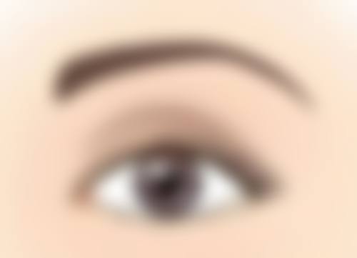 哪种隆鼻方式比较好之注射隆鼻：无创变得更美的捷径