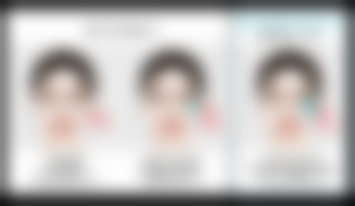 哪种隆鼻方式比较好之自体软骨隆鼻：自然美的优选