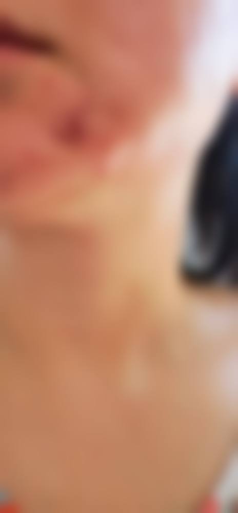 赖宽医生项目优势