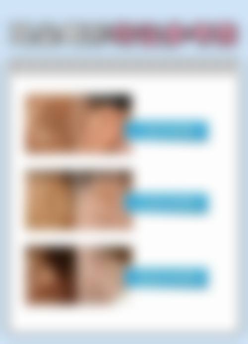 佛山禅城明兮和本整形医院怎么样之口碑好不好?附真实患者口碑评价