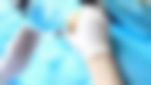 修复烫伤疤痕的办法有哪些——武汉正璞医院