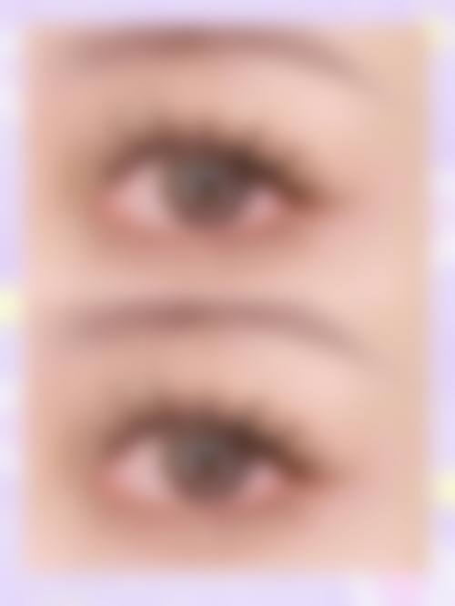 韩国毛治植发中 心资质怎么样