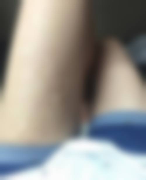 皖南医学校第一附属医院烧伤整形科口碑好不好？附真实患者口碑评价