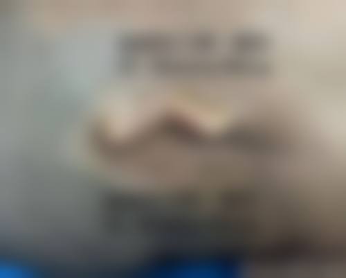 耳软骨隆鼻尖能一辈子吗——上海倍思特医疗美容门诊部综合评价