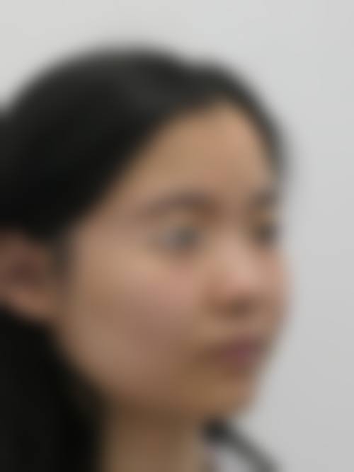 潍坊世纪华中医疗美容门诊部顾客实例