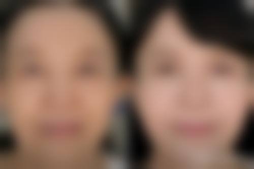 河南郑州乔熙画整形医院价格表