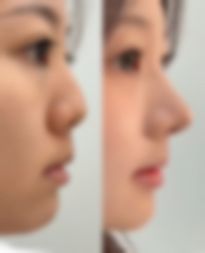 佛山禅城明兮和本整形医院怎么样之地址及乘车路线