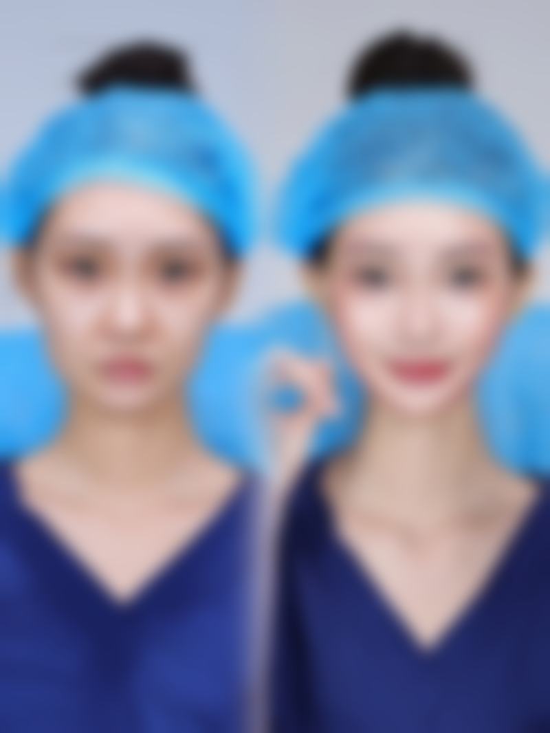 日常护理与预防：疤痕管理的“持久战”