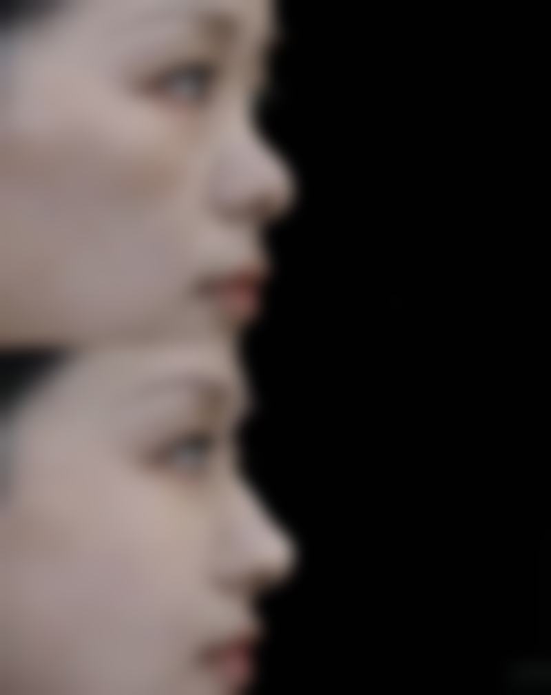 河南郑州乔熙画整形医院项目特色