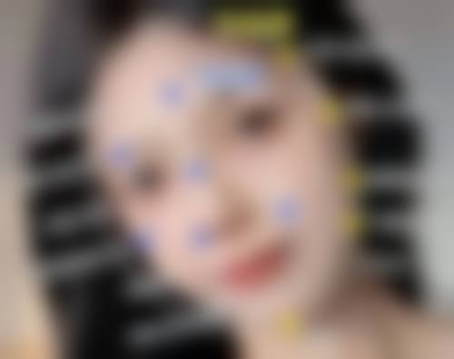 黄庆吉医生做手术价格