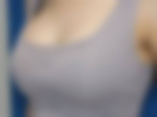 邹洁医生做手术价格