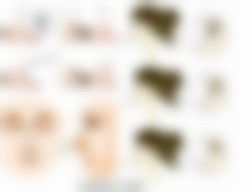 王玉秀医生简介之做手术价格