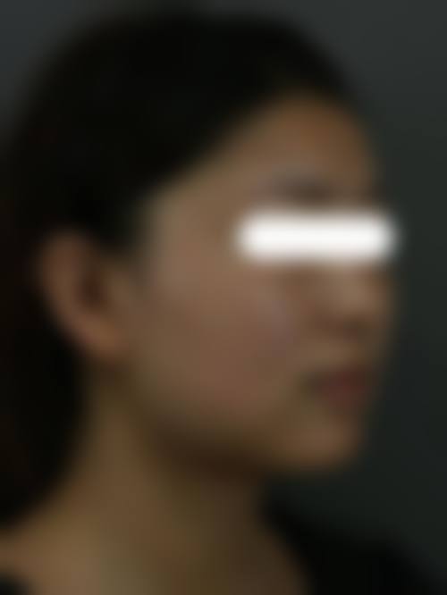 柳州市城中区华美医疗整形美容门诊部价格表