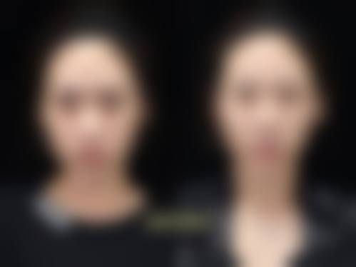 八、长沙天心伊百丽整形医院怎么样——价格表