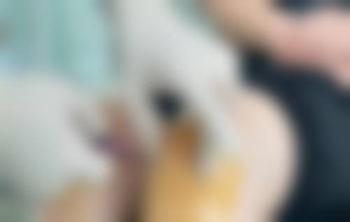 易平光医生简介做手术价格