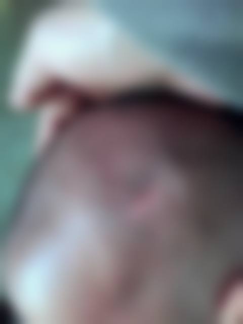 珠海邵丽娜医疗美容诊所怎么样，价格表