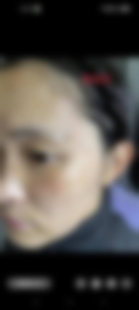 易平光医生简介项目优势