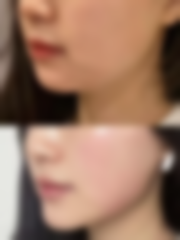 宁波海曙澳玛星光悦容医疗美容诊所怎么样，怎么挂号，地址在哪儿