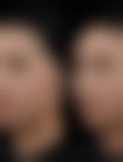 广西玉林庄芝美整形医院价格表