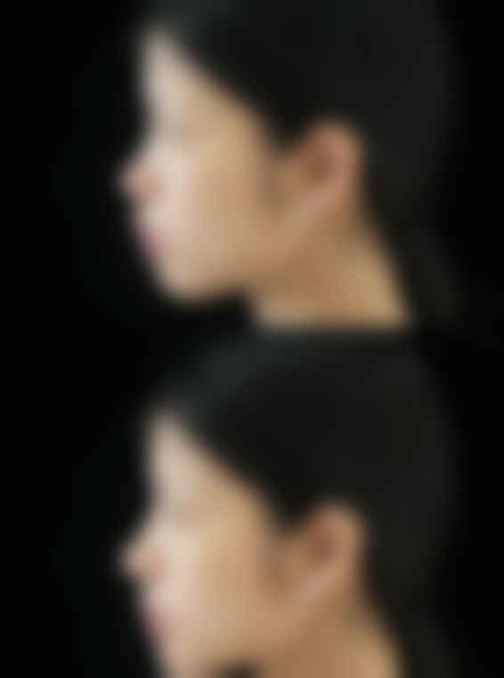 赵丹丹医生做手术价格