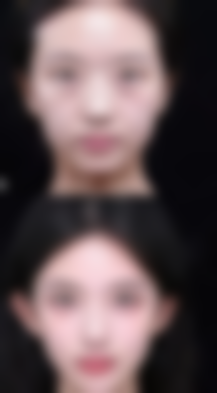 深圳迎悦医疗美容怎么样？口碑好不好？