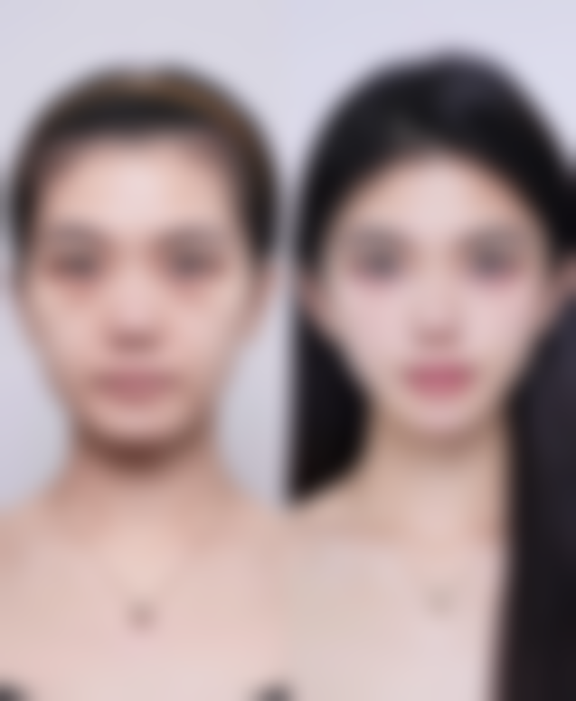 易平光医生简介怎么挂号