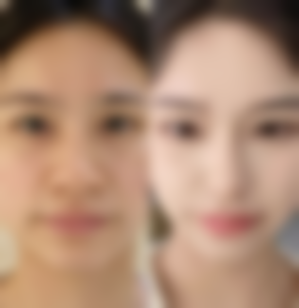 八、珠海美南华整形医院价格表:合理价格提供优质服务