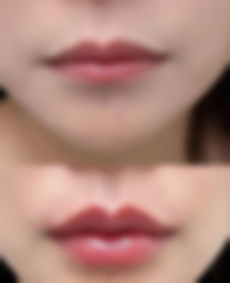 央金医生做手术价格