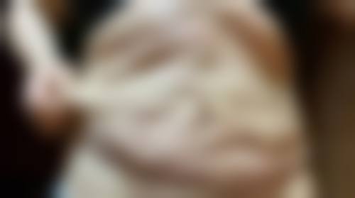 张文丽医生简介之项目优势