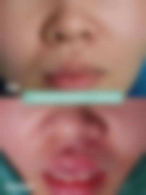 南宁伊轮美医疗美容外科诊所怎么样，可靠吗