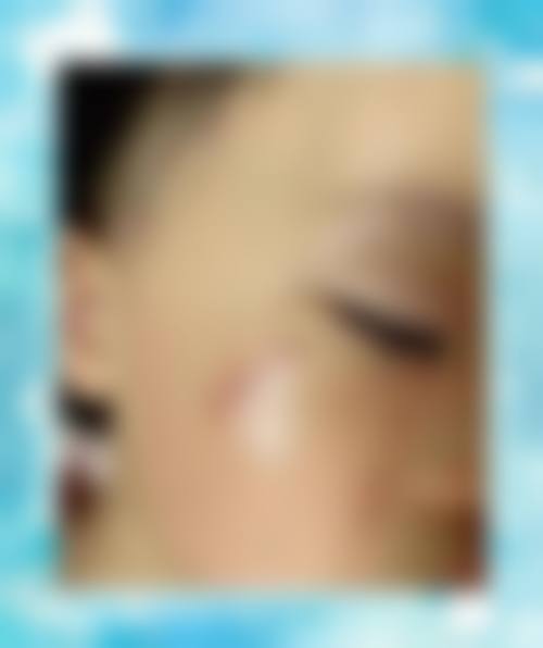 沈阳国防医院腋臭整形科医生简介