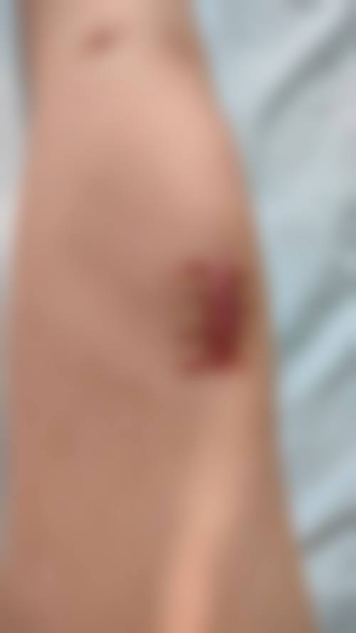 沈阳国防医院腋臭整形科怎么样,口碑评价如何?