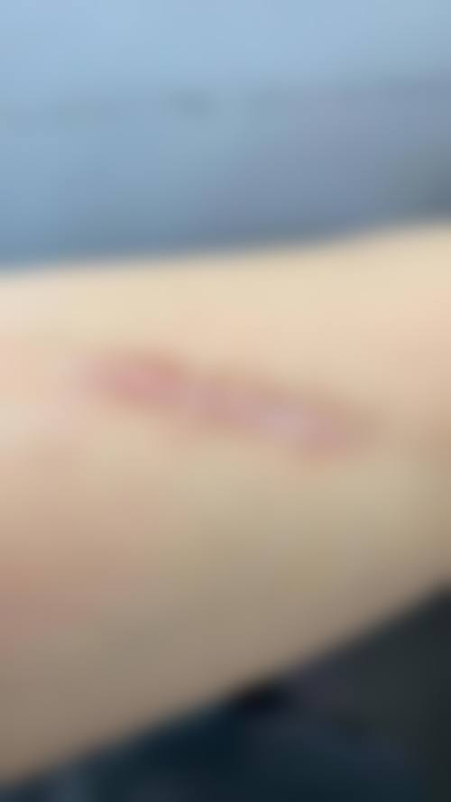 益阳格莱美整形美容门诊部价格表