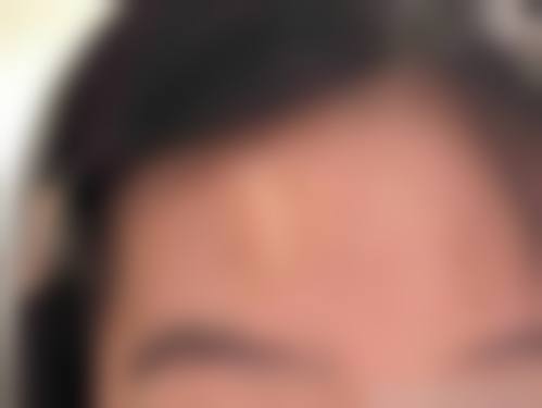 淄博市市立医院皮肤美容整形科项目特色