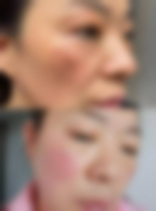 七、秦皇岛琪媛整形医院真实患者口碑评价——实力赢得满意