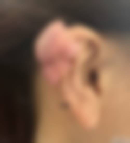 天津樱柏妍整形医院价格表