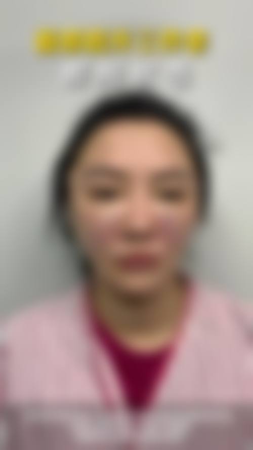 全宇平医生做手术价格